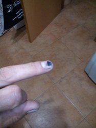 dedo.jpg