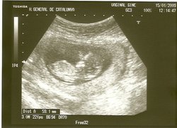 eco1-12 semanas.jpg